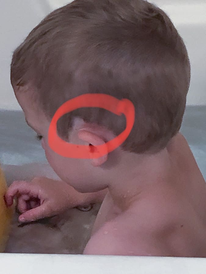 a boy's haircut with a chunk missing