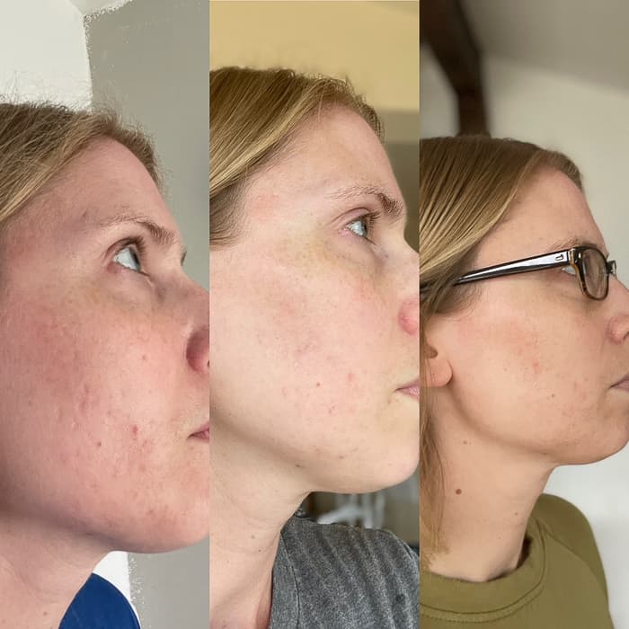 3 side profiles of a woman's face