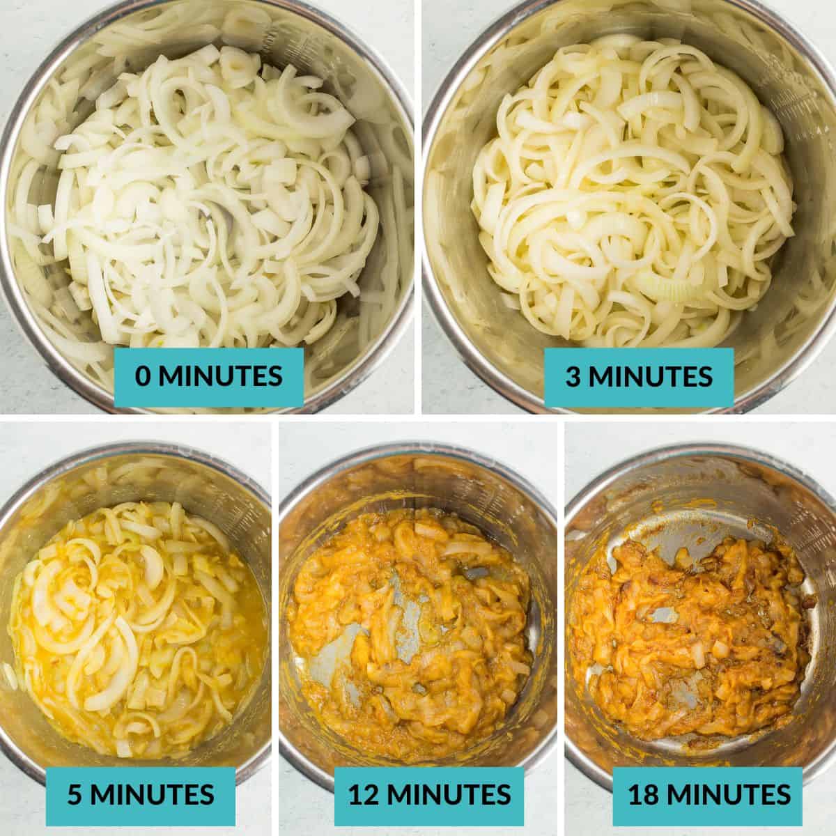5 photos showing the process of caramelizing onions in a pressure cooker.